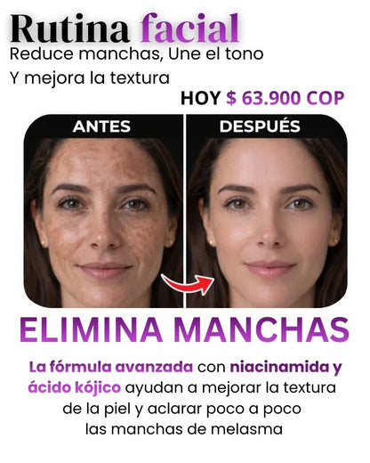 CREMA ELIMINA MANCHAS S10 COLAGENO + OBSEQUIO