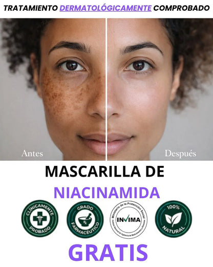 KIT ADIÓS MANCHAS Y ACNÉ +OBSEQUIO TIENDA OFICIAL