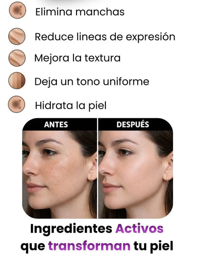CREMA ELIMINA MANCHAS S10 COLAGENO + OBSEQUIO