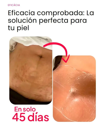 Candela crema reductora 300ML