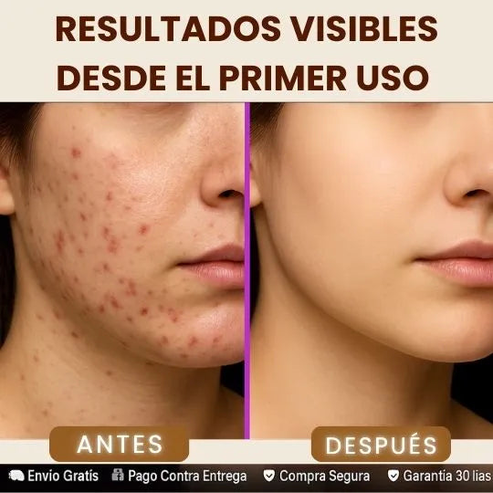 JABON SALICILICO-1019 SERUM SALICIL + OBSEQUIO