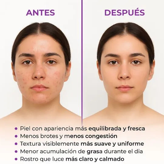 CREMA LIMPIADORA DE NIACINAMIDA S10