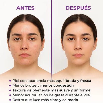 CREMA LIMPIADORA DE NIACINAMIDA S10